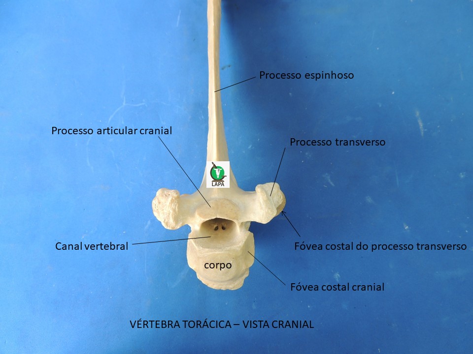 vértebra torácica vista cranial