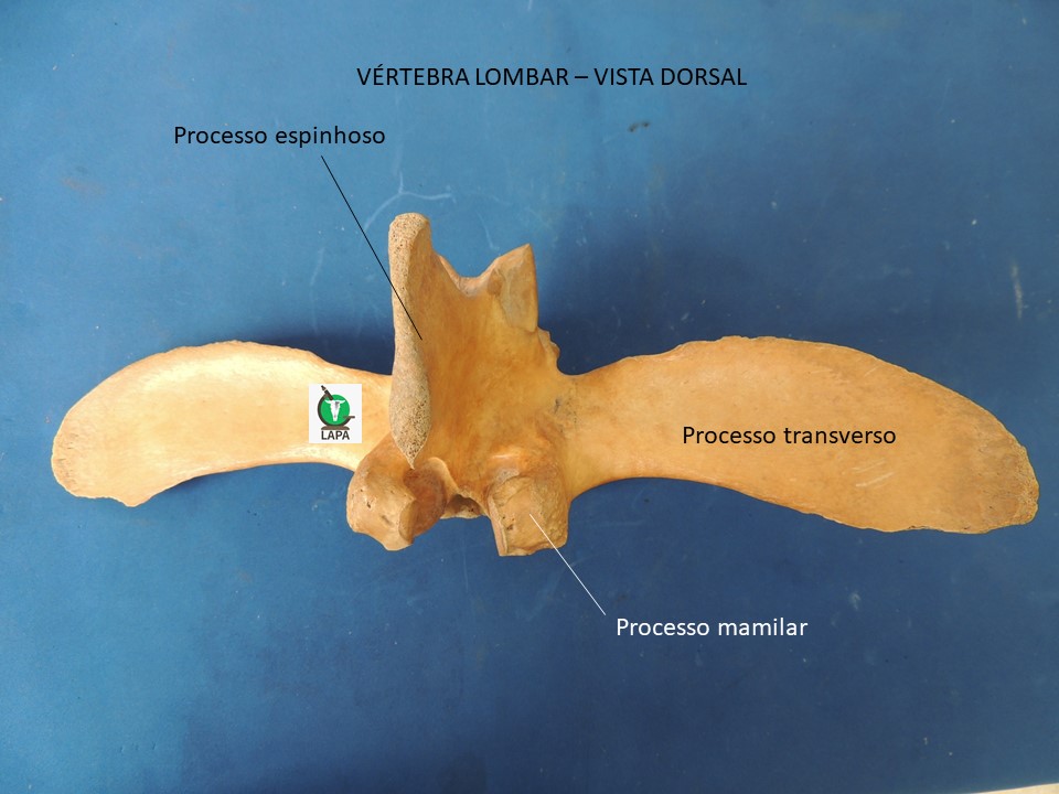 vértebra lombar vista dorsal