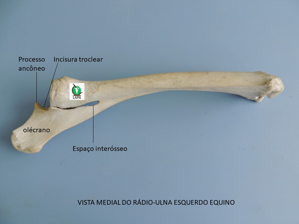 rádio e ulna vista medial