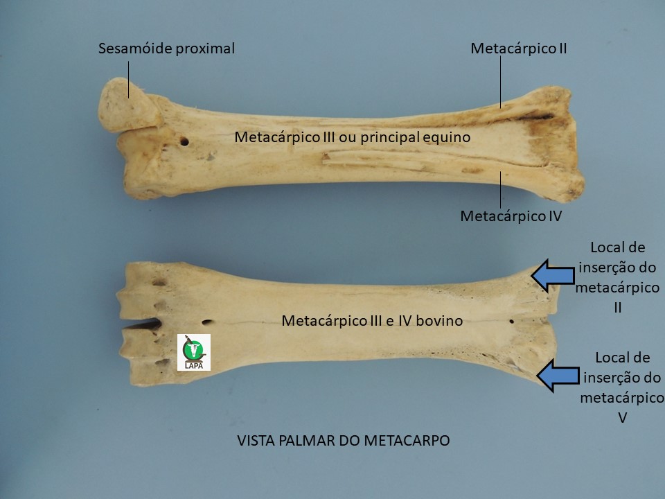 metacárpicos vista palmar