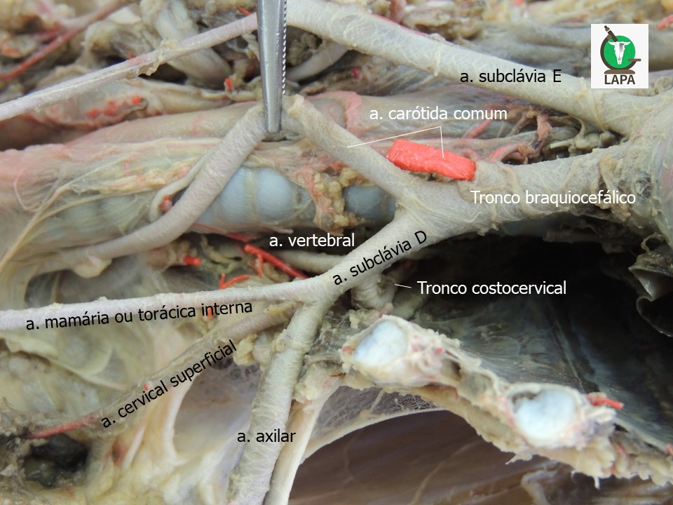 ramos do tronco braquiocefálico