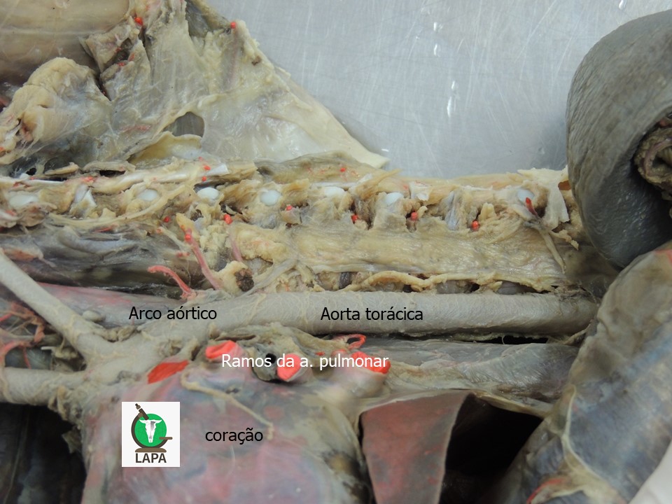 aorta torácica