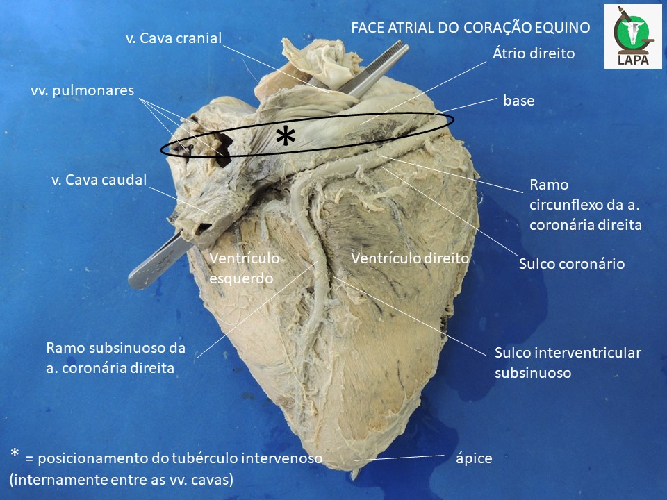 coração