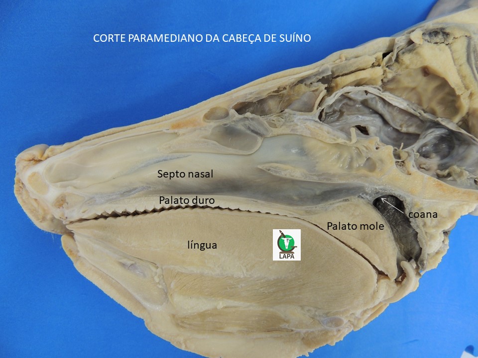 septo nasal