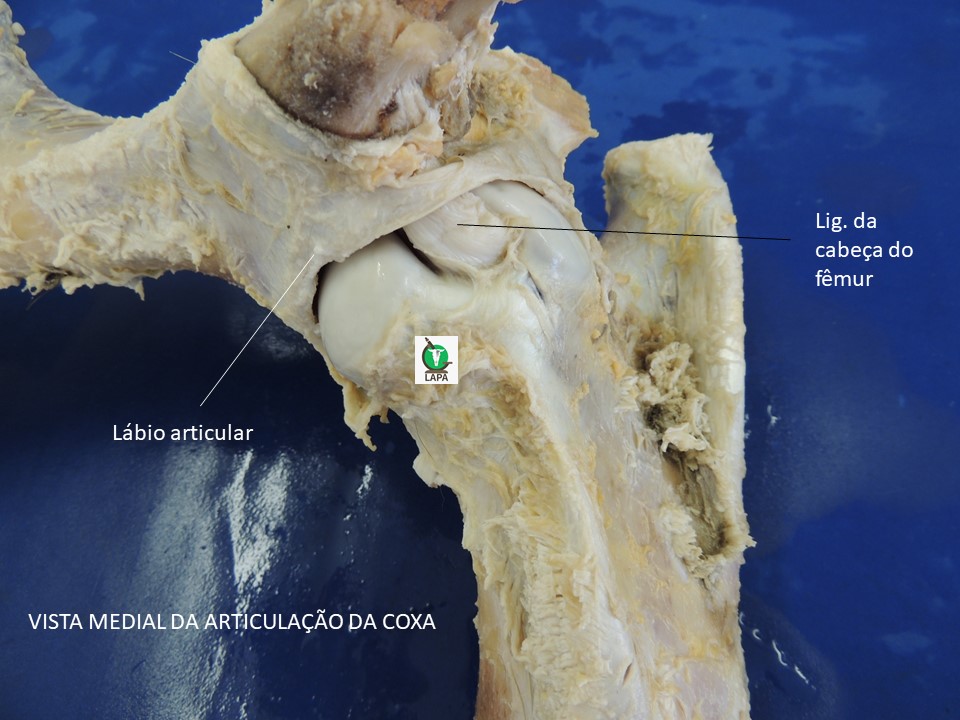 detalhe vista medial art coxa