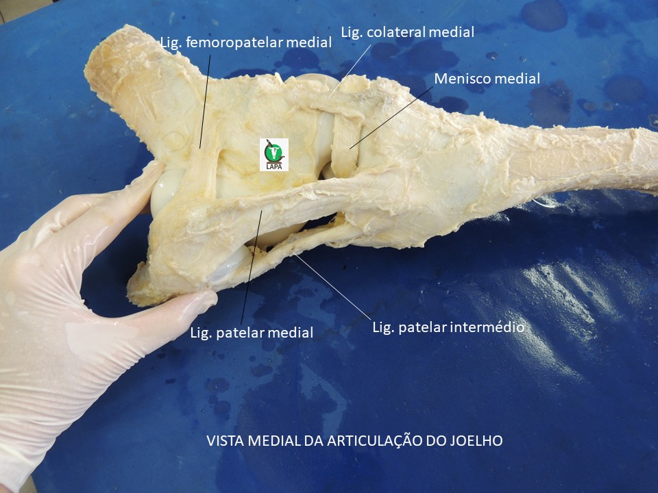 joelho medial equino