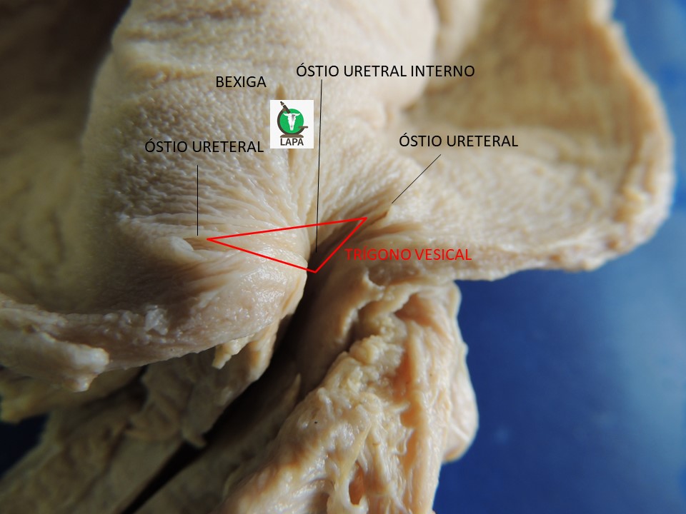 trígono vesical