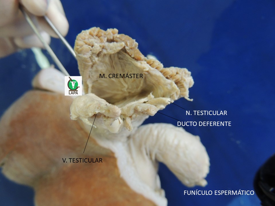funículo espermático