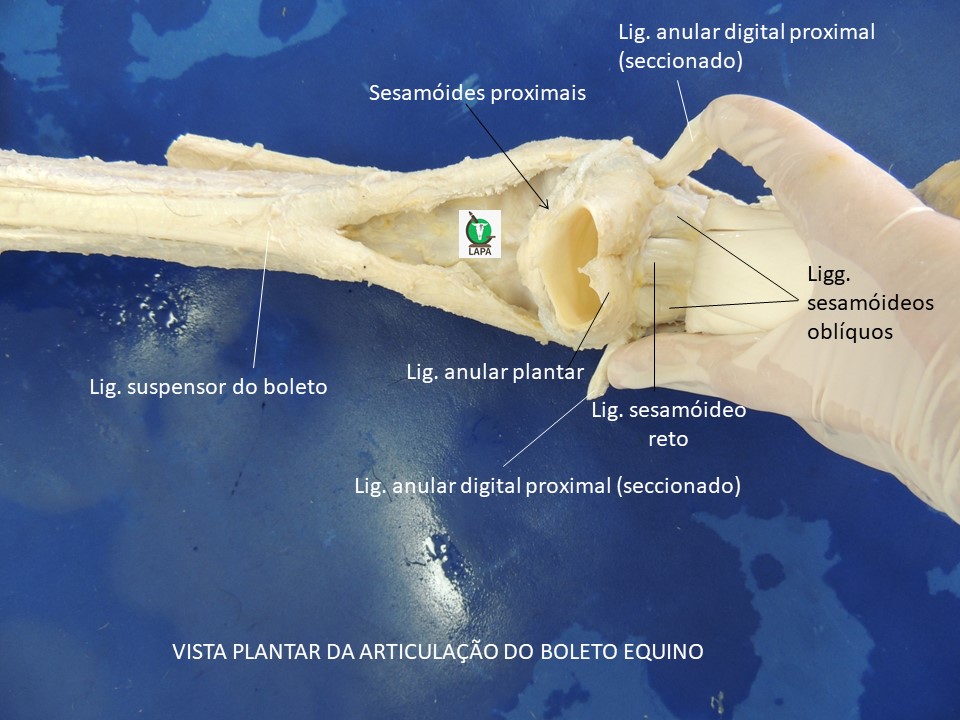 vista plantar art metatarso falangeana