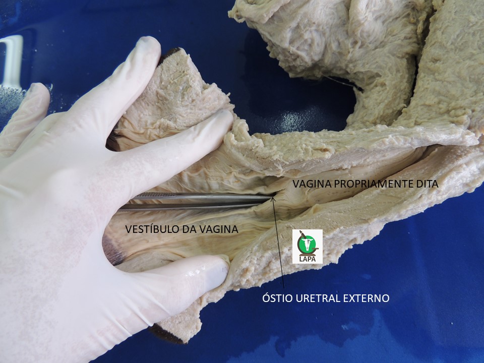 vestíbulo da vagina