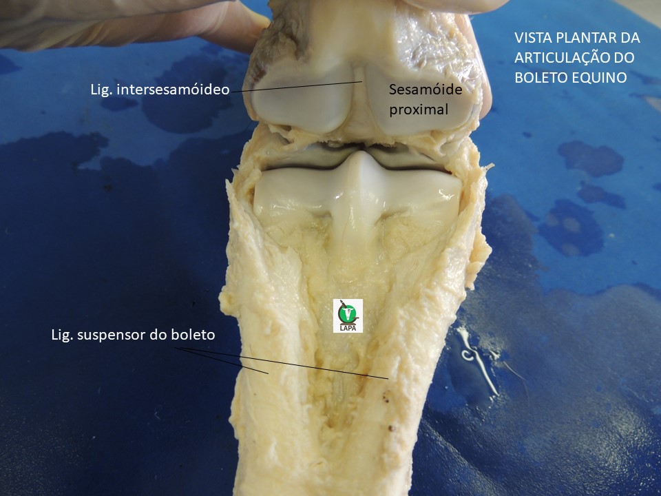 vista plantar sesamóides proximais rebatidos