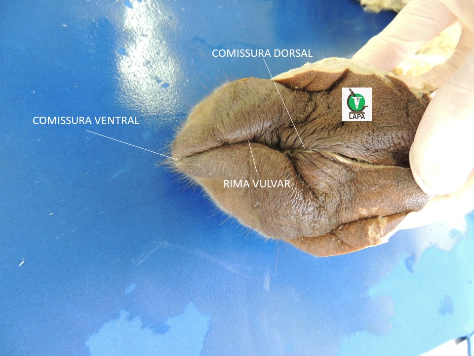 vulva