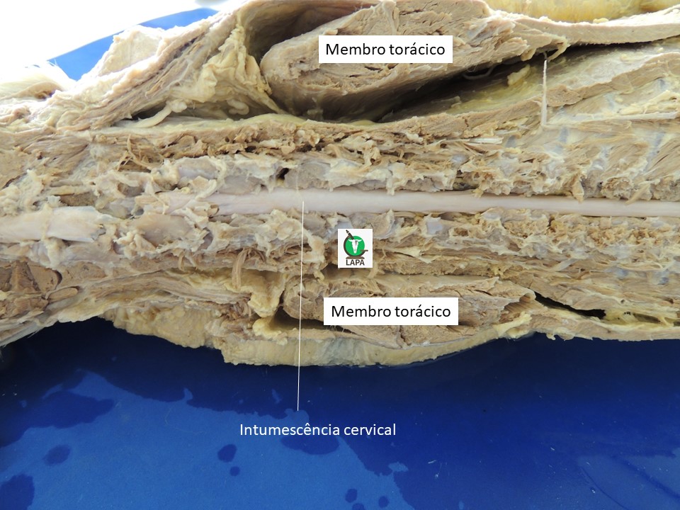 intumescência cervical