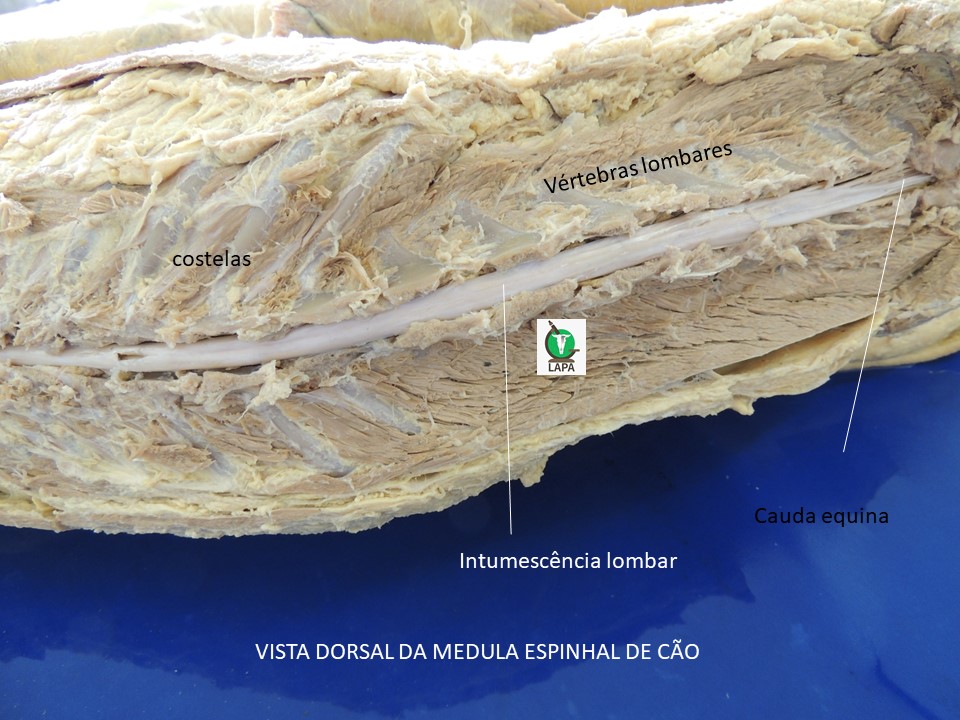 intumescência lombar