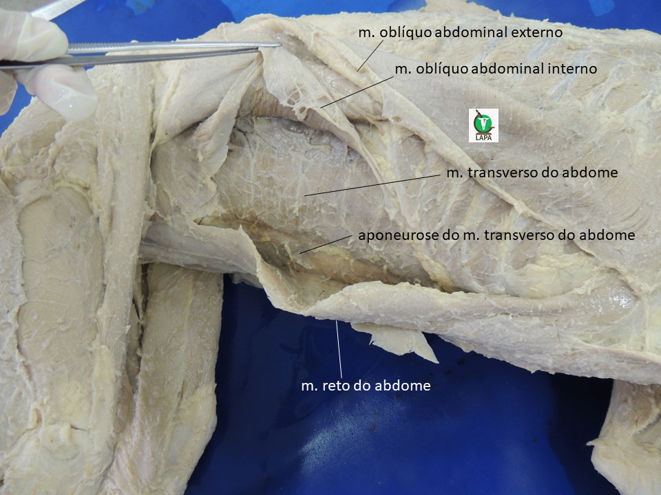 vista lateral abdome