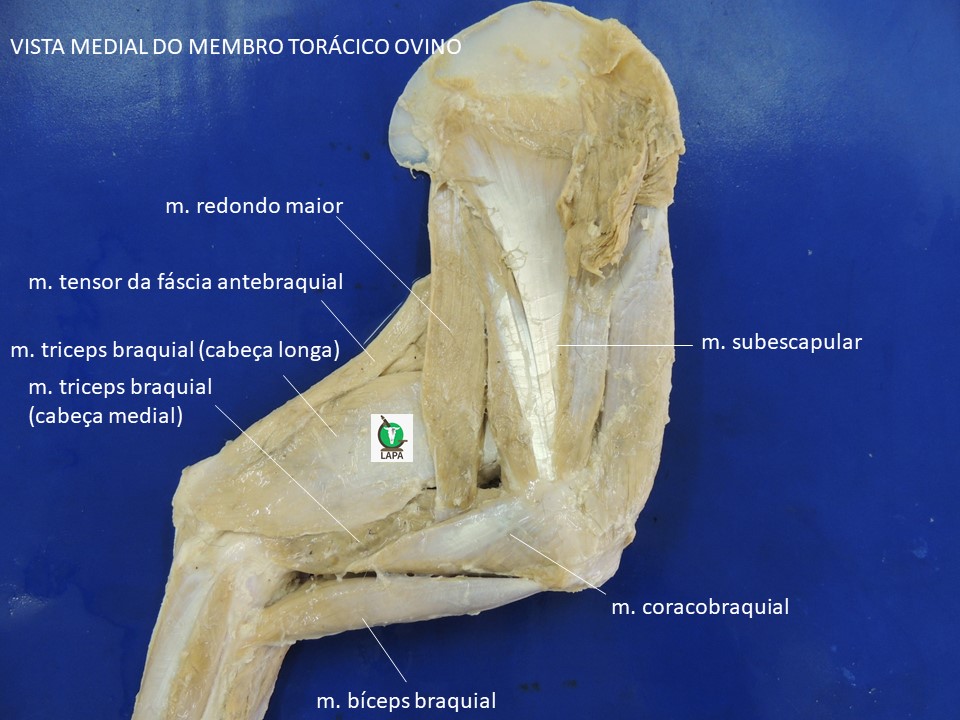 vista medial proximal