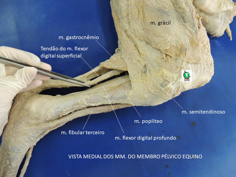 vista medial perna