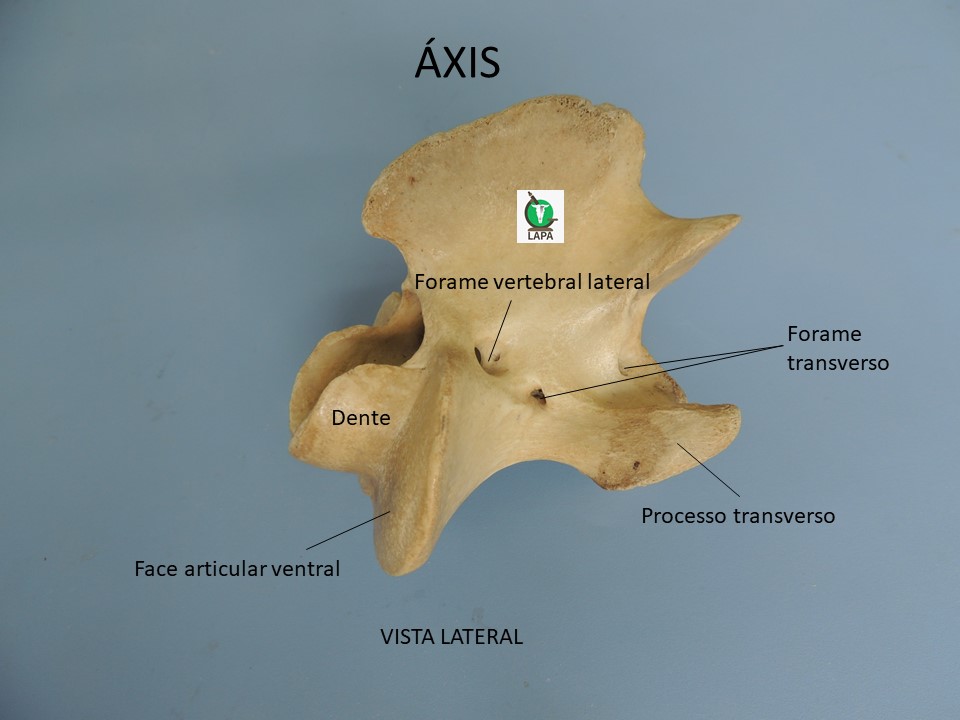 axis vista lateral