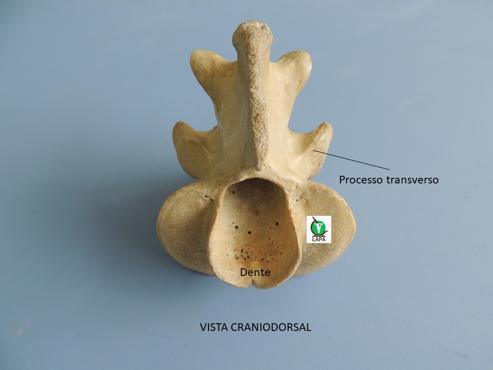 axis vista cranial