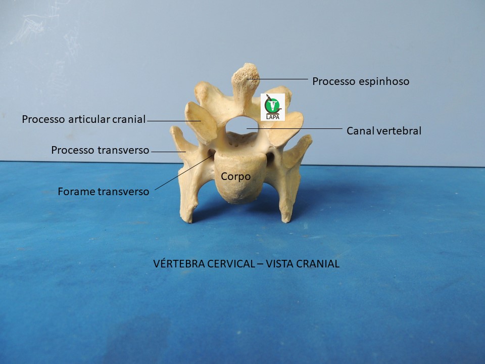 vértebra cervical vista cranial