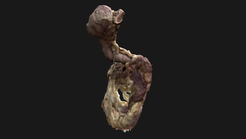 estomago-duodeno-pancreas