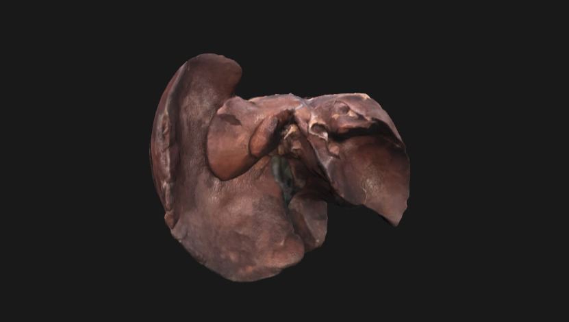 figado