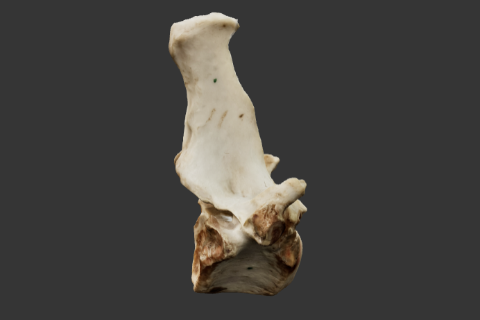 15-vertebra-toracica
