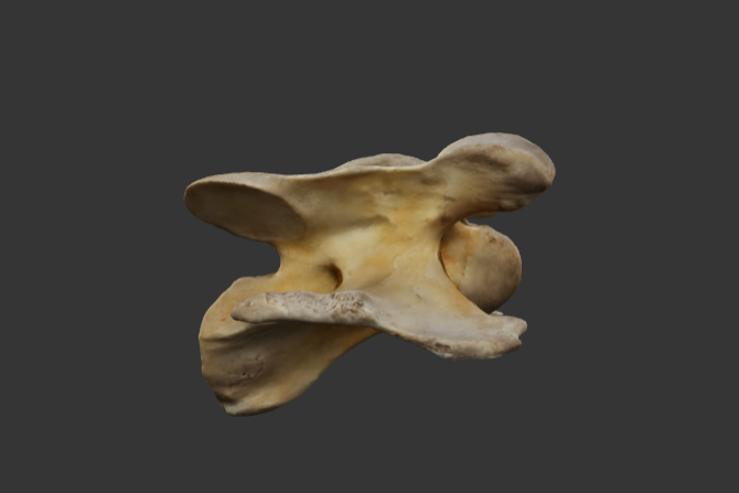 3-6-vertebra-cervical