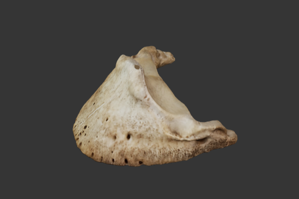 falange-distal-toracico
